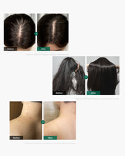 hair_treatment_180x