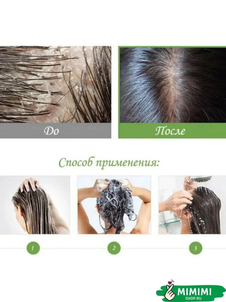 Шампунь от перхоти с яблочным уксусом Masil 5 Probiotics Apple Vinegar Shampoo 8мл*20шт